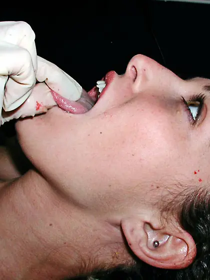 n6157 - Case-0C164E2 - Ember,  Mena