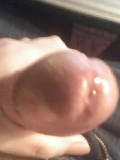 My Penis