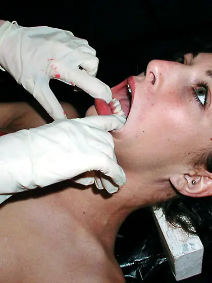 n6157 - Case-0C164E2 - Ember,  Mena