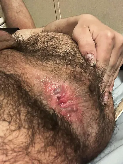 I want to be fisted and rimmed my hairy pink hole