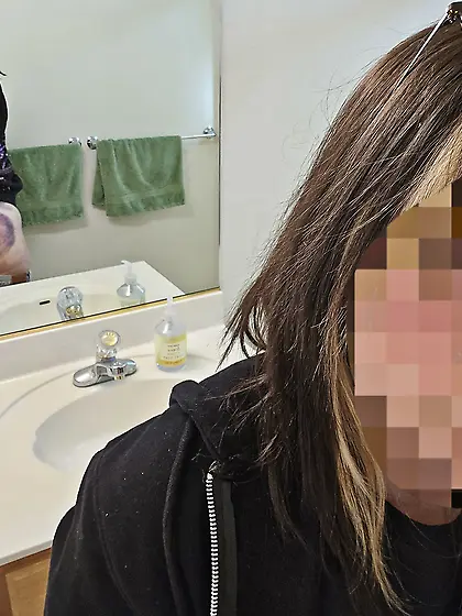 Bruises from my Owner