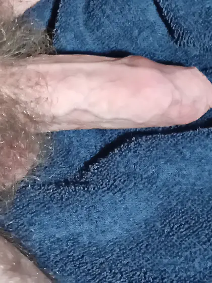 Hairy penis