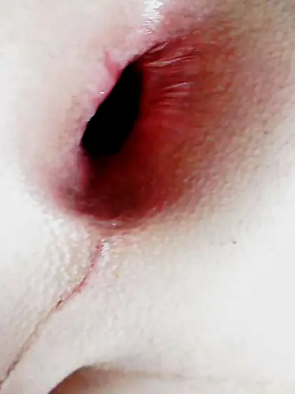 Fresh yr fresh gape,  fresh knuckle,  fresh stretch,  fresh ass ins