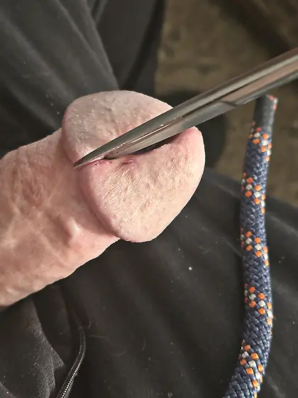Cutting more of my glans