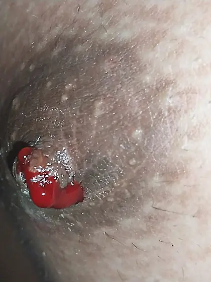 Close up bloody nipple