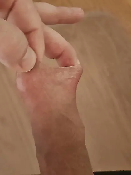 Geil mit der Vorhaut spielen