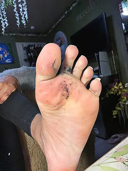 Nigger nub nutrients