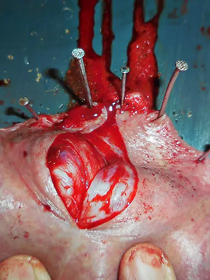 20260218 Sadist made me to open my scrotum