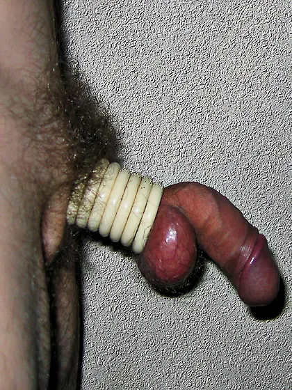 Rings stuck in a penis