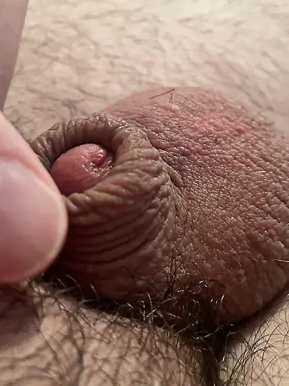 Tiny dick,  very small micropenis