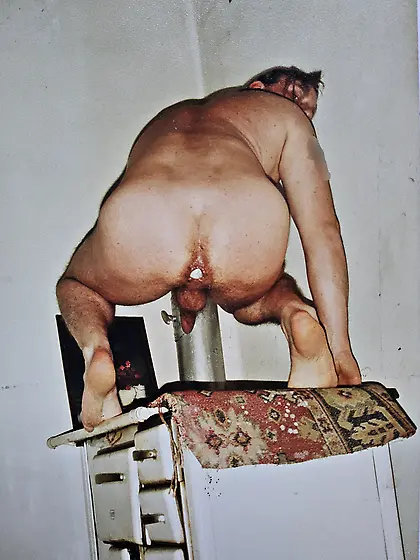 Anal guy pushing Ball out Hemorrhoids