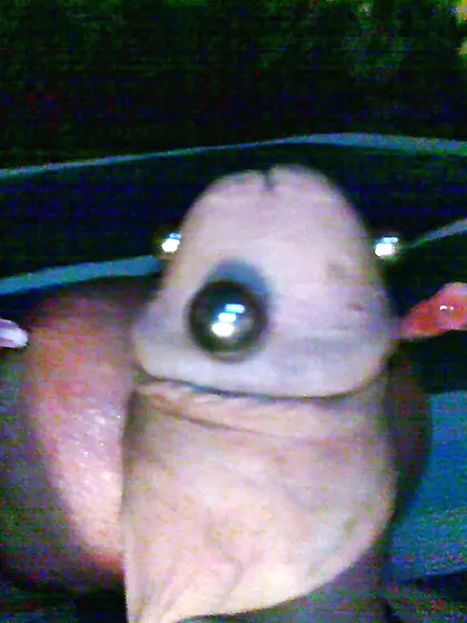 Nutsack medical play