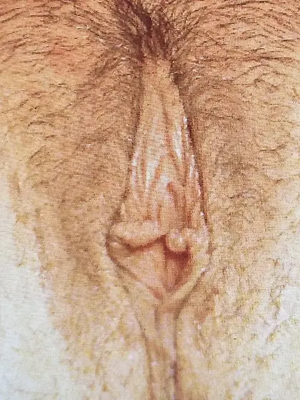 huge saggy pussy lips