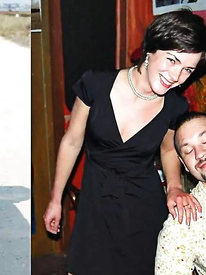 Before after 316 (diminutive baps exclusive)