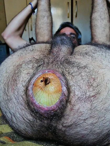 I inserted a huge onion into my ass