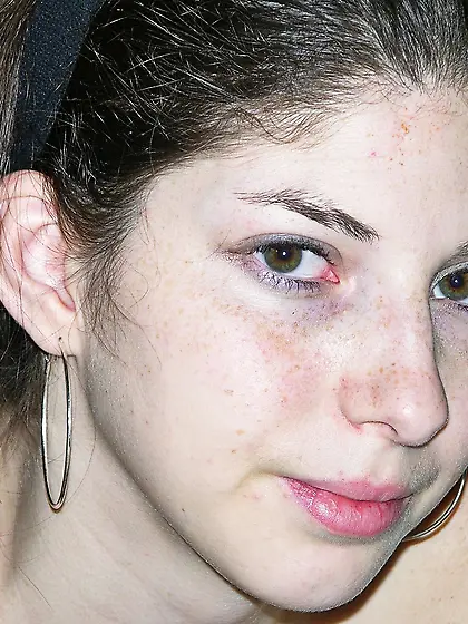 FRECKLED FACE PETITE TEEN