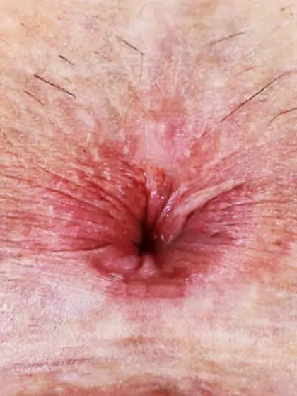 Mira has a nice asshole for fucking