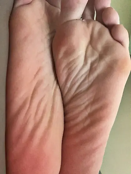 My wrinkly,  soft,  perfect teen soles (follow me)