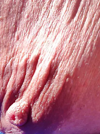 Saggy Hangers at Beach