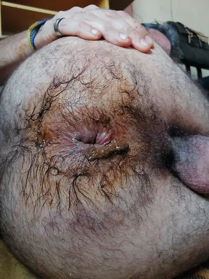 My dirty hairy anus
