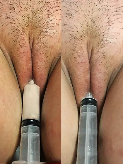 Cum injection