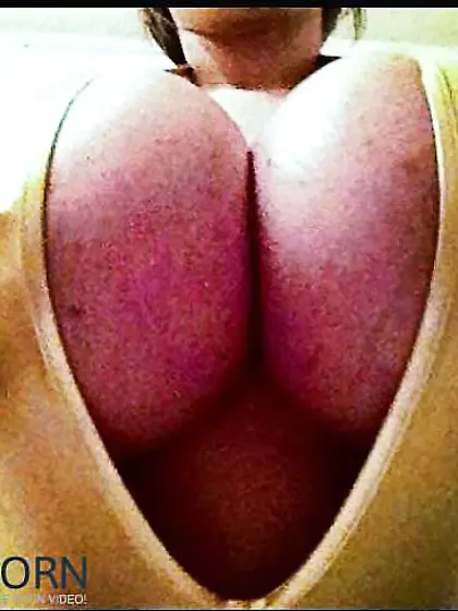 Brooke Blue: Ginormous Fake Monster Breasts!