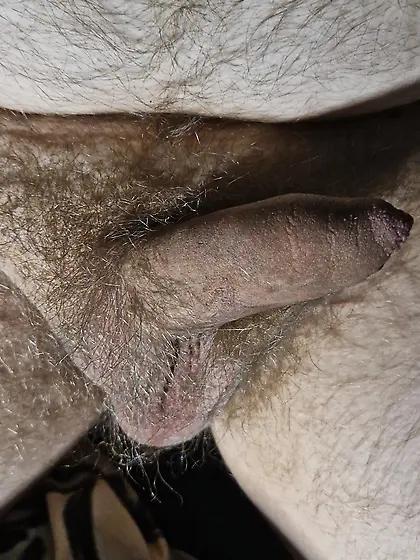 Fat guy with small cock and one testicle