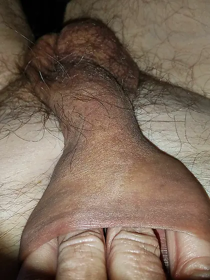 XXL foreskin to be filled with a cock or a big gla