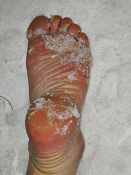 My feet on snow.  Temperature -20°C.