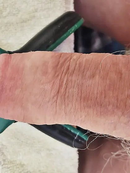 Foreskin Torture and Stretch