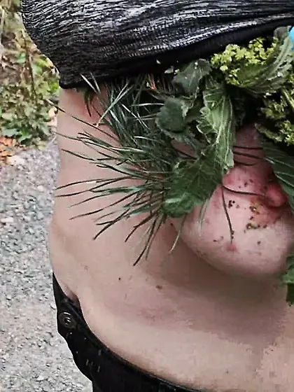 Nettles and other stuff in my bra and slip