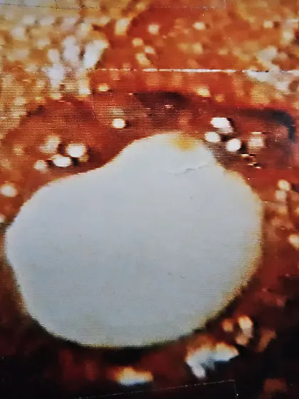 my Asshole Hemorrhoids white Ball in Ass