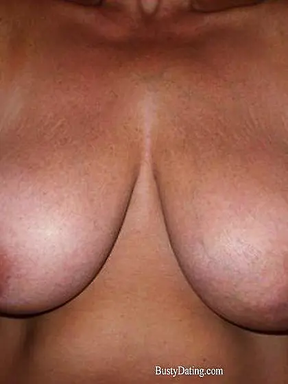 Busty Breast Reductions - Set 25