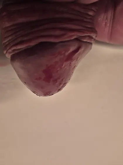 Conséquences des tout petits vers de farine