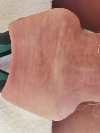 Foreskin Torture and Stretch