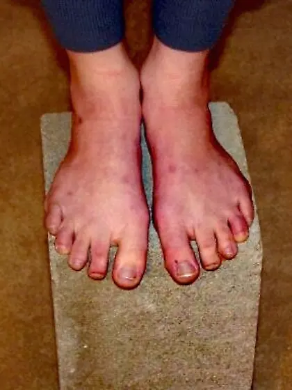 Annabellesfantasy & Annesdreams Gallows