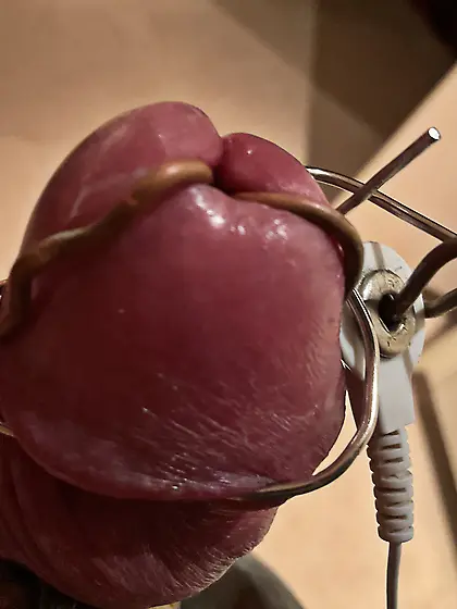 Estim,  foreskin stretched back,  glans cbt