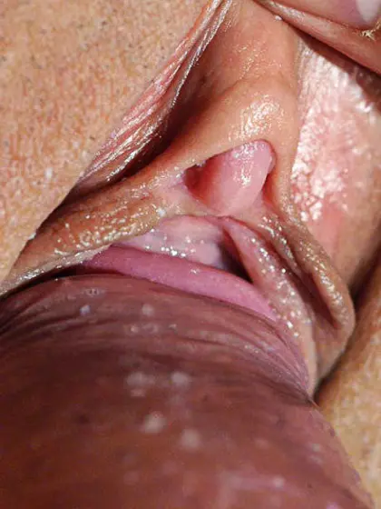 Close Up Collection 6