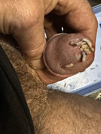 Maggots stuffed