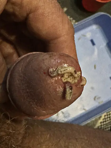 Maggots stuffed