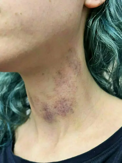 blue hair slut showing off for us