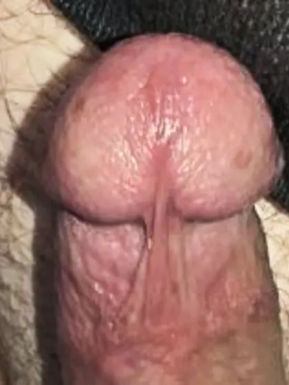 My cock head