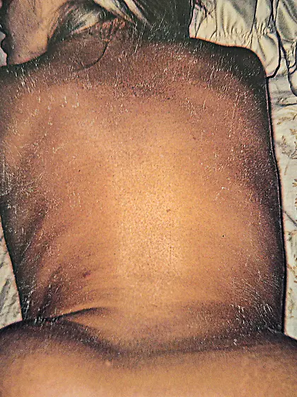 Hoes in different area codes