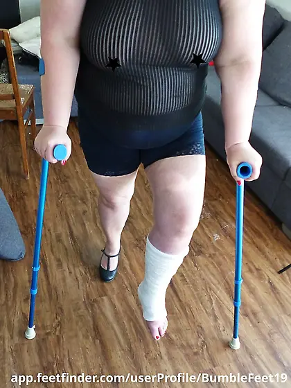 More leg cast foot fetish and bbw belly show off
