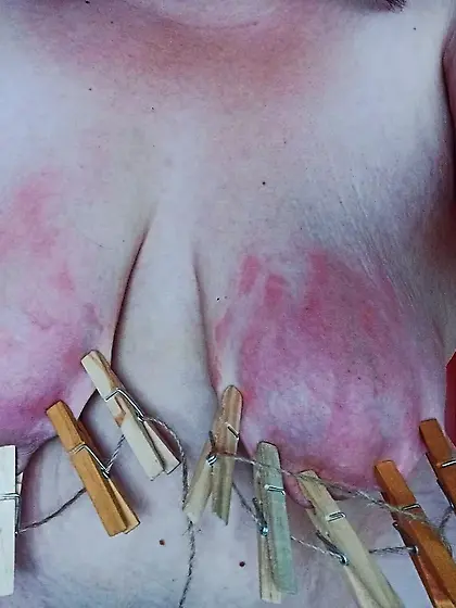 Don't they look pretty when they are bruised and abused?,