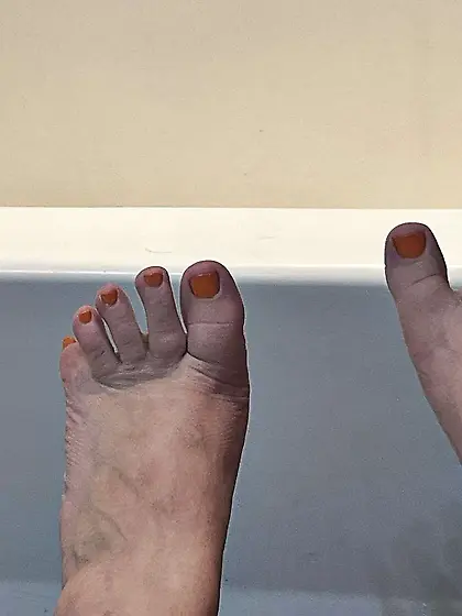 G’ana the fat dirty whore