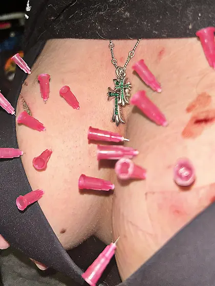 needle play