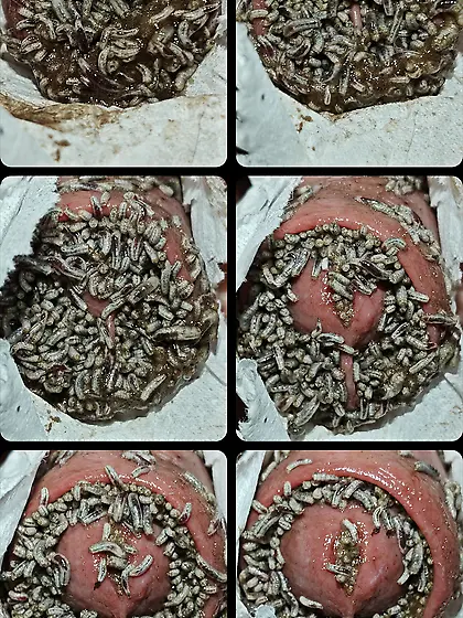 That's a maggot infection