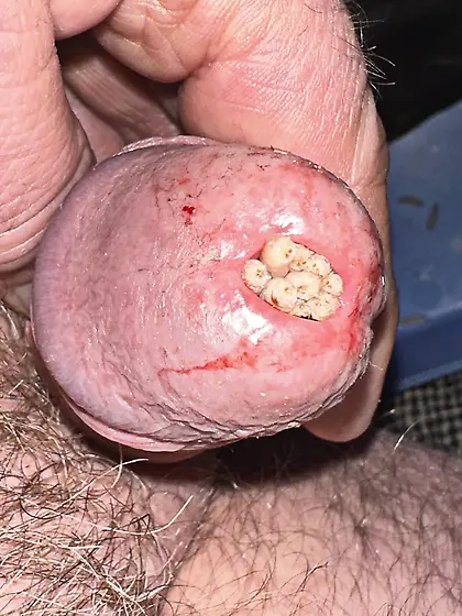 Maggots stuffed