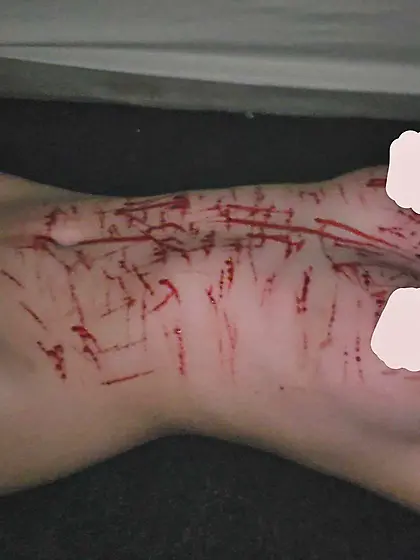 【R's Breast Cuts Collection】